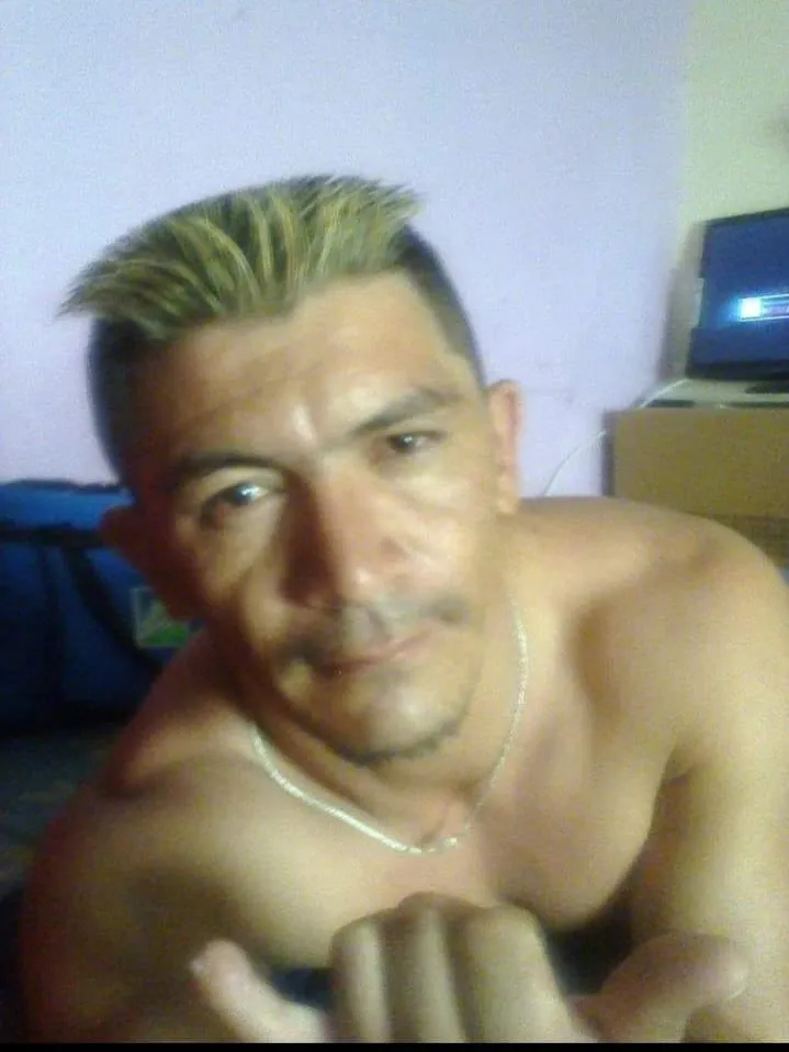 Pedrossegundense sofre grave acidente de moto e família organiza bingo beneficente 