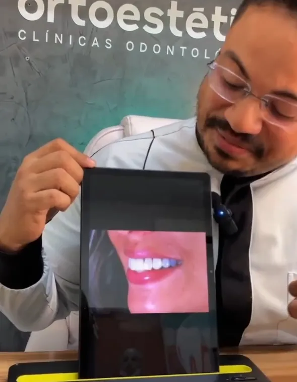 Recupere a confiança no seu sorriso em 2025 com os implantes dentários da Ortoestética!