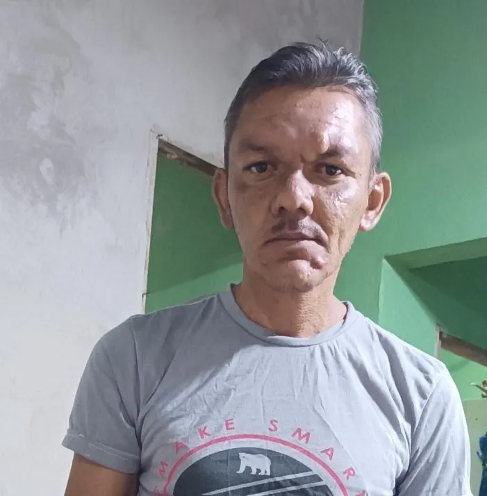 Pedrossegundense sofre grave acidente e família realiza campanha solidária