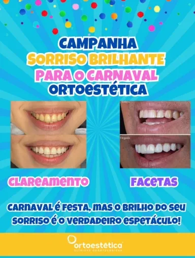 Deixe seu sorriso radiante neste carnaval com clareamento e facetas da Ortoestética!