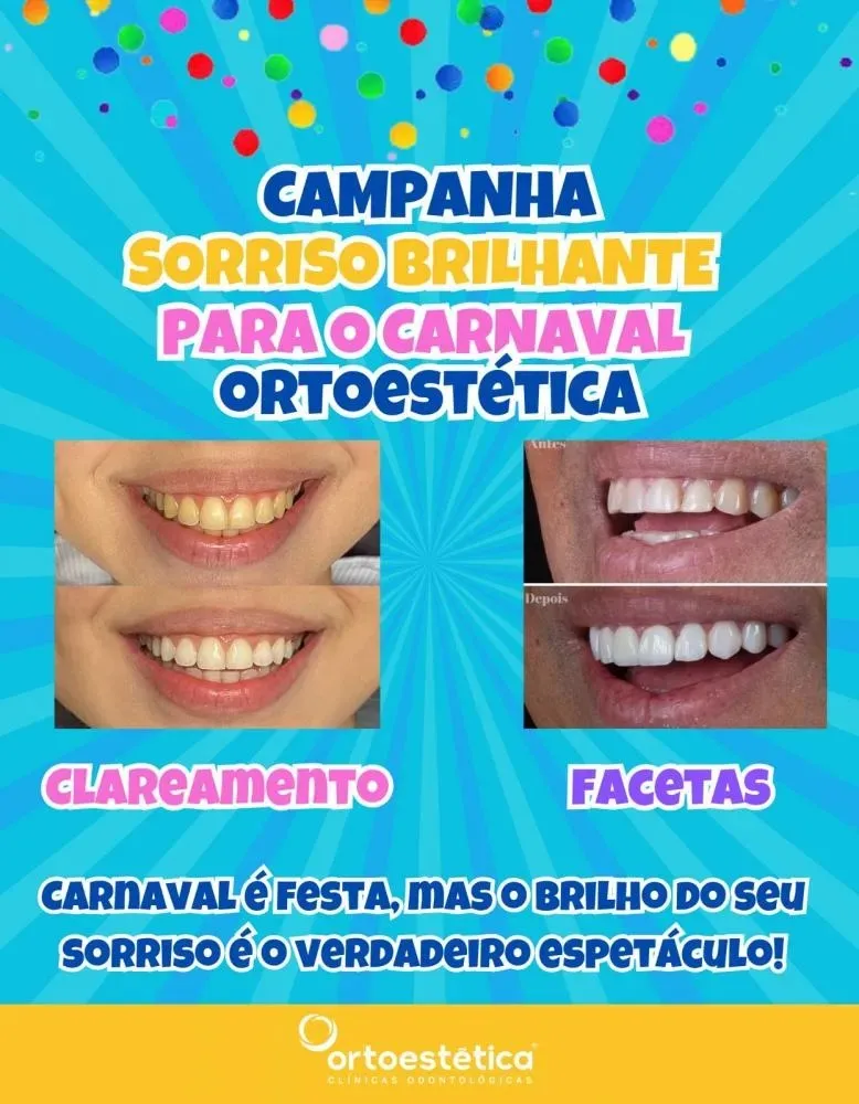 Brilhe neste carnaval com as facetas e clareamento dental da Ortoestética de Pedro II!
