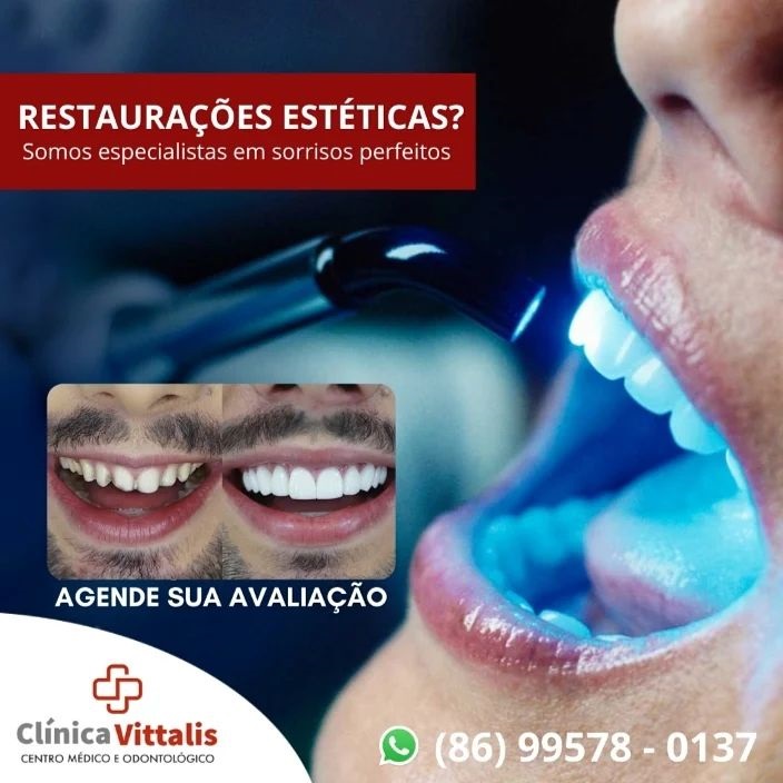 Agende já a sua avaliação e traga o seu sorriso de volta na Clínica Vittalis de Pedro II 