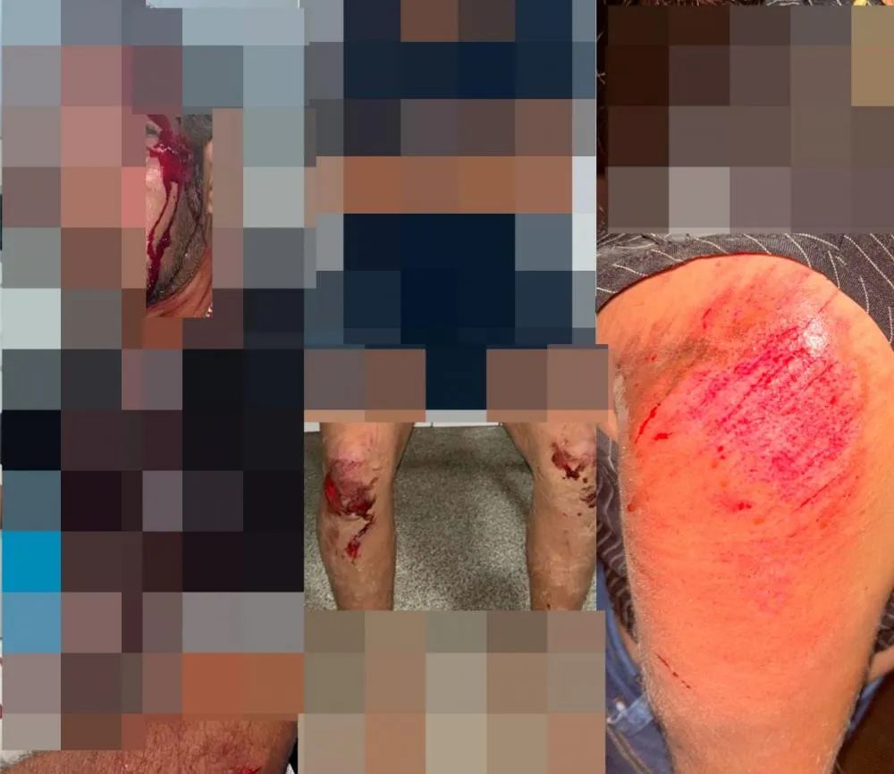 Família fica ferida após colisão provocada por motociclista com suspeita de embriaguez em Milton Brandão