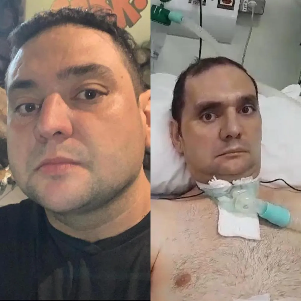 Homem natural de Milton Brandão enfrenta reabilitação após AVC e aneurisma; família promove campanha para custear cuidados