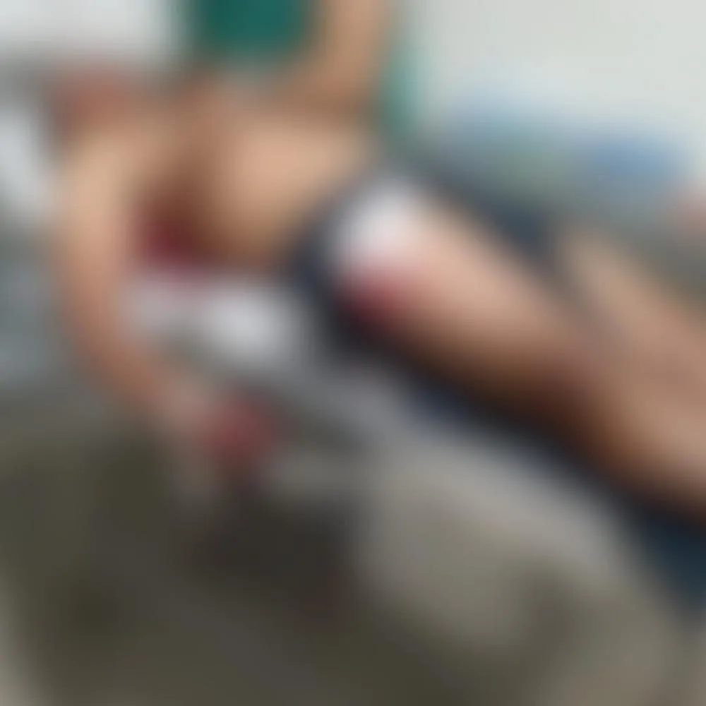 Homem fica gravemente ferido após acidente na PI-216, em Milton Brandão