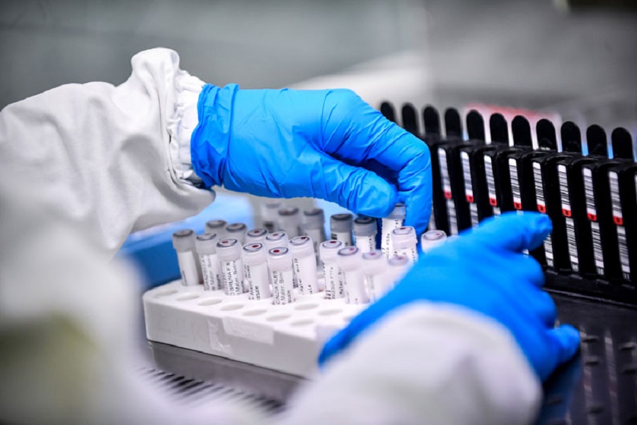 Piauí registra mais 267 casos de covid-19 e três óbitos em 24h